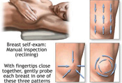 Mobile Mammography, Mobile Digital Mammography, Breast Cancer Screening, Women's Wellness