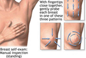 Mobile Mammography, Mobile Digital Mammography, Breast Cancer Screening, Women's Wellness