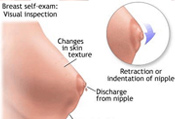 Mobile Mammography, Mobile Digital Mammography, Breast Cancer Screening, Women's Wellness